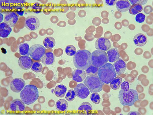 Клинический анализ крови гемосиндром инвитро thumbnail