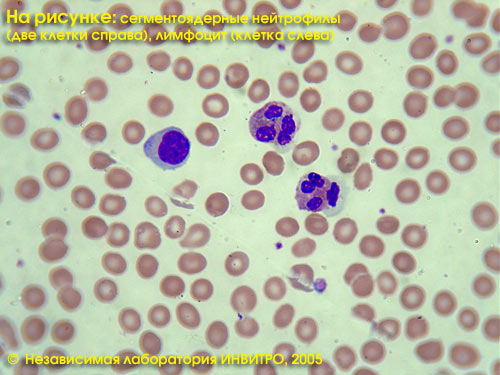 Экспресс анализ крови на лейкоциты thumbnail