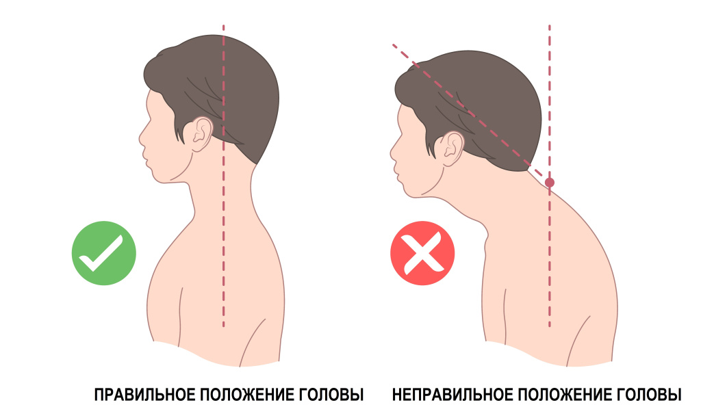 Неправильная поза.jpg