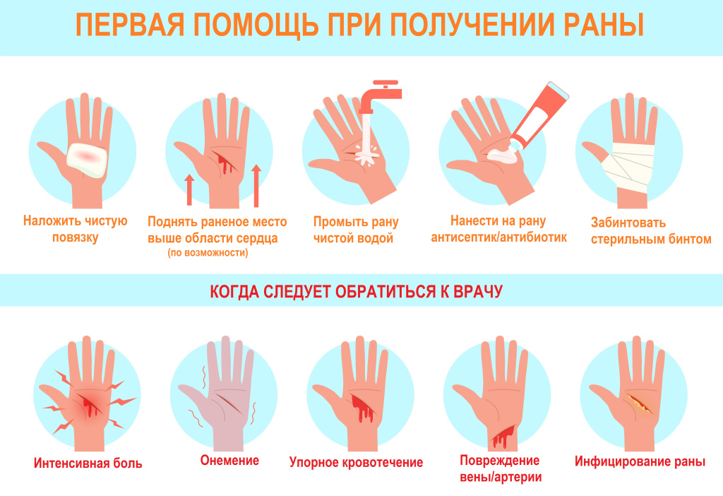 Современный подорожник: как лечить ссадины и раны на коже?