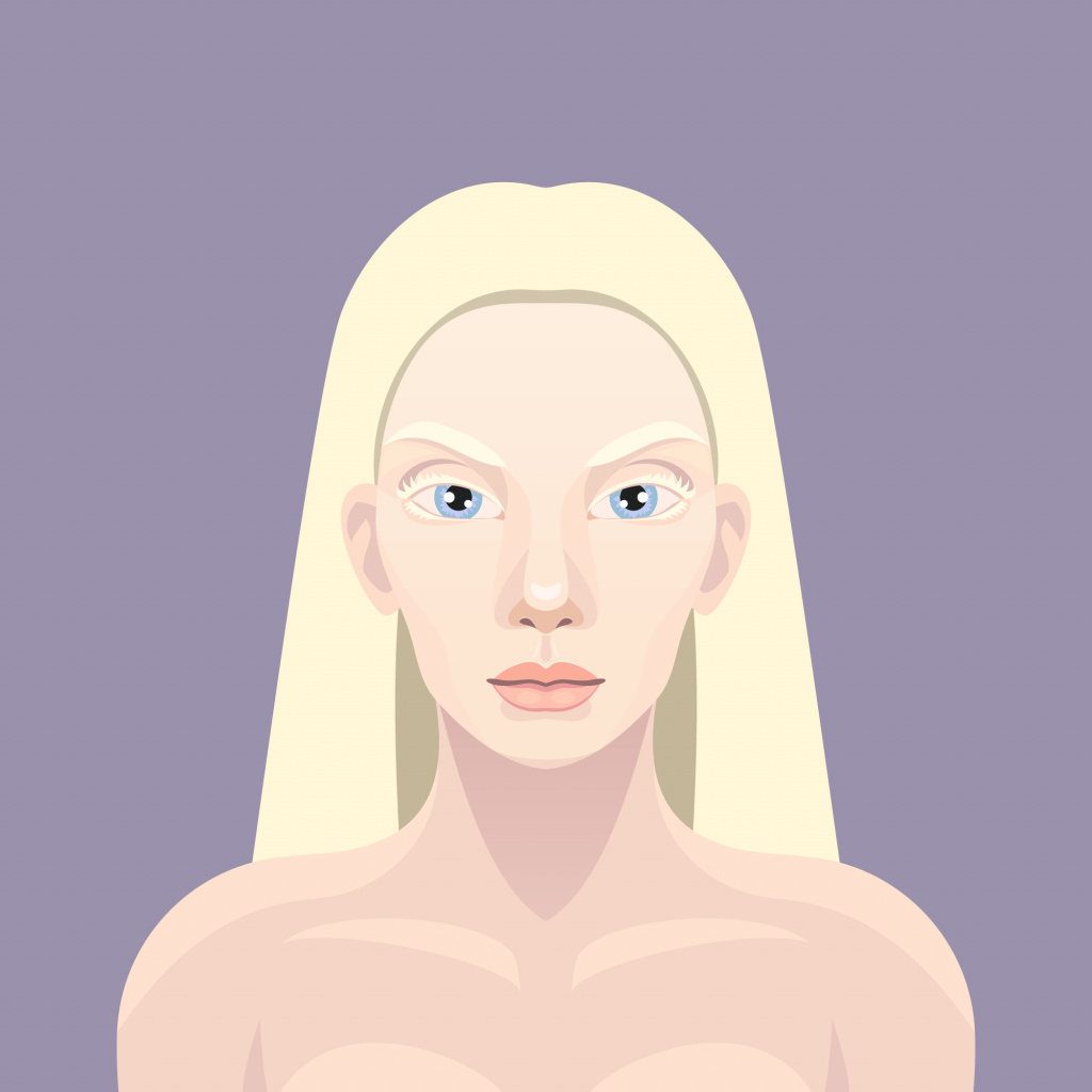 Альбинизм.jpg