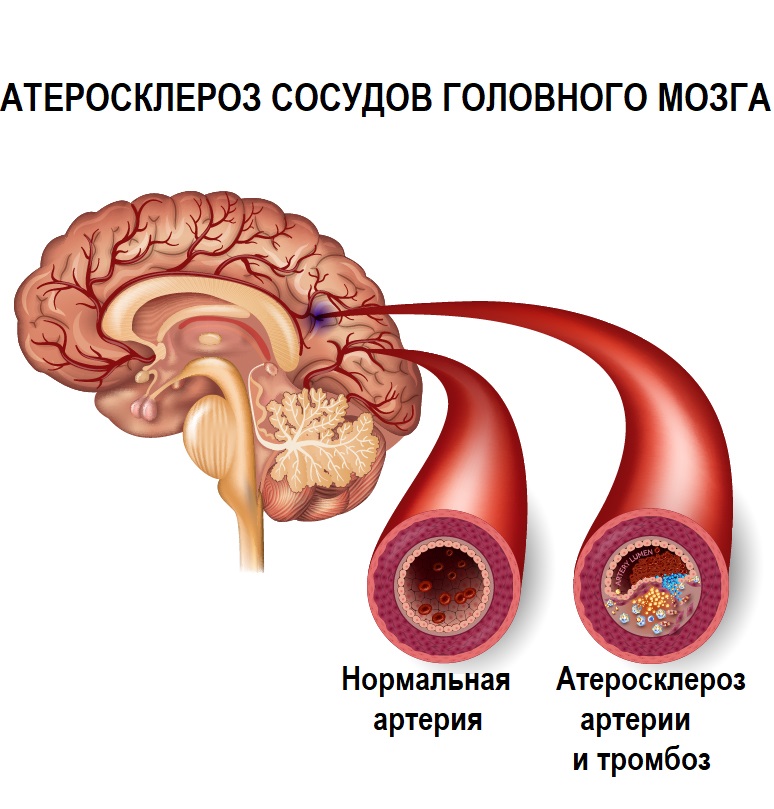 Сосуды.jpg