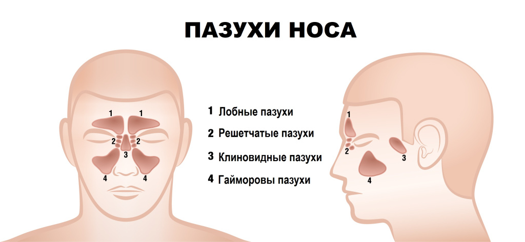 Лечение кисты в носу (носовой пазухе)