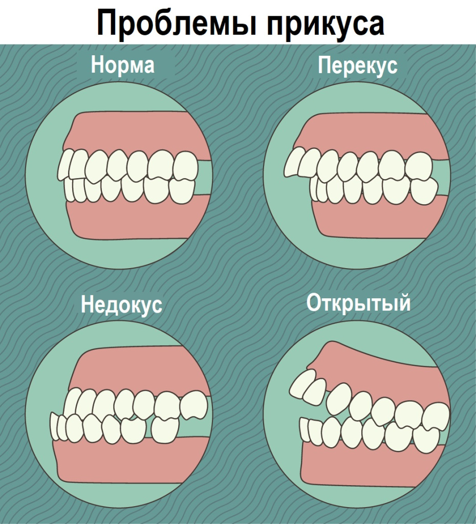 Зубы.jpg