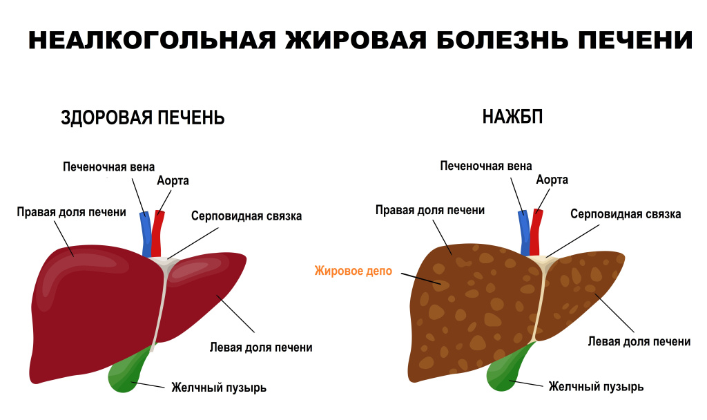 Печень.jpg