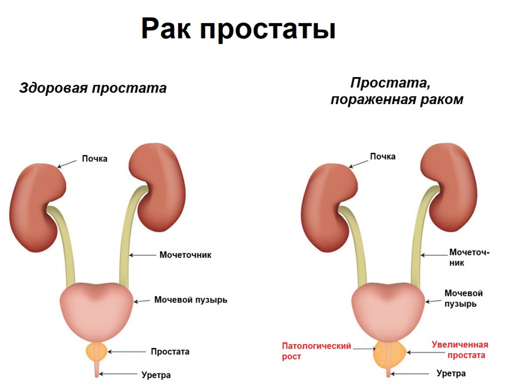 Энурез - симптомы, признаки, причины и лечение у взрослых в Москве в «СМ-Клиника»
