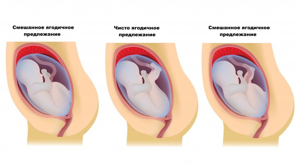 Этапы беременности. Оплодотворение и имплантация