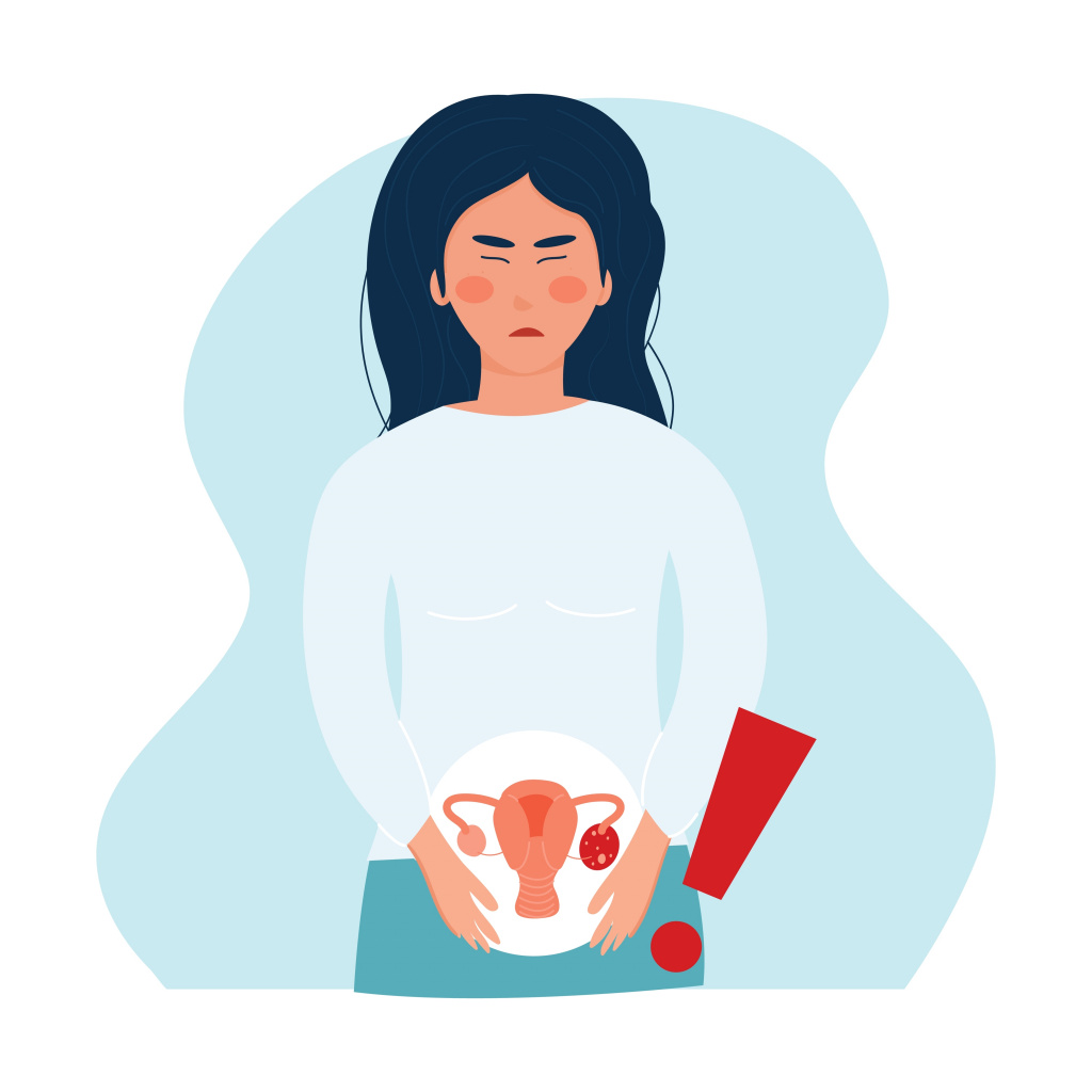 Апоплексия яичника: первые признаки, симптомы и лечение болезни