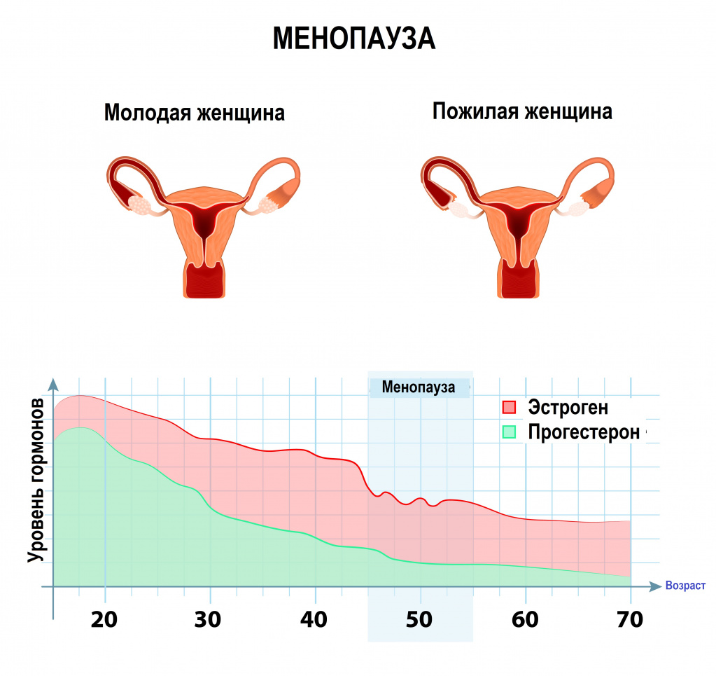 Климактерический период (климакс у женщины): симптомы и лечение