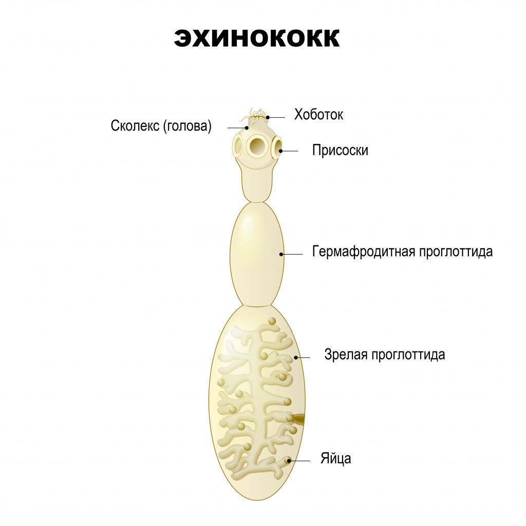 Львовские медики обнаружили случай редкого заболевания, которое вызывают ленточные черви