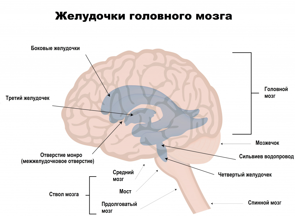 Гидроцефалия головного мозга у детей