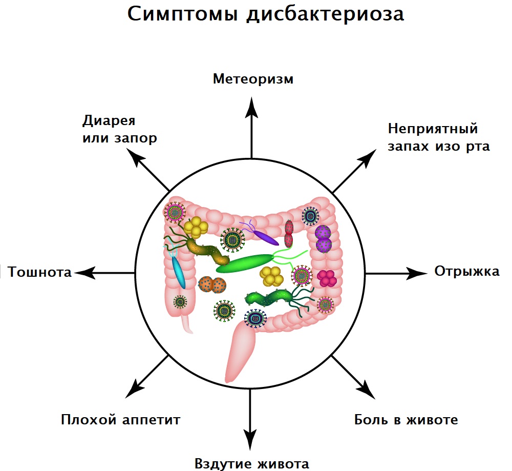 Дисбактериоз - причины, симптомы, диагностика и лечение